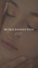 PCOS Skincare: My Journey to Calm, Clear Skin from Hormonal Acne and Oily Skin
