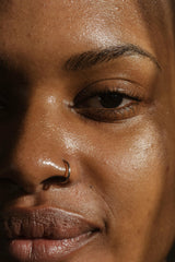 Why Isn't My Hyperpigmentation Fading?