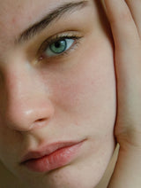 The Complete Guide to Rosacea: Symptoms, Causes, Triggers, and Treatment