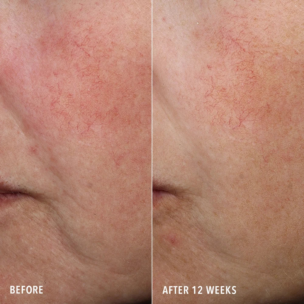HydroPeptide Syner-C+ Serum 30ml