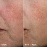 HydroPeptide Syner-C+ Serum 30ml