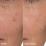HydroPeptide Syner-C+ Serum 30ml
