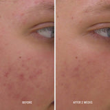 HydroPeptide Clear Rescue Serum 30ml