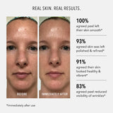HydroPeptide Polish & Plump Peel 2 x 30ml