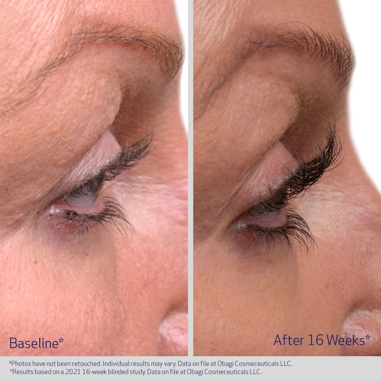 Obagi Medical Nu-Cil Eyelash Enhancing Serum 3ml