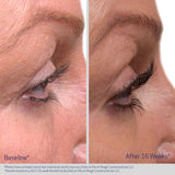 Obagi Medical Nu-Cil Eyelash Enhancing Serum 3ml