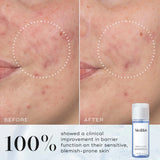Medik8 Press & Clear