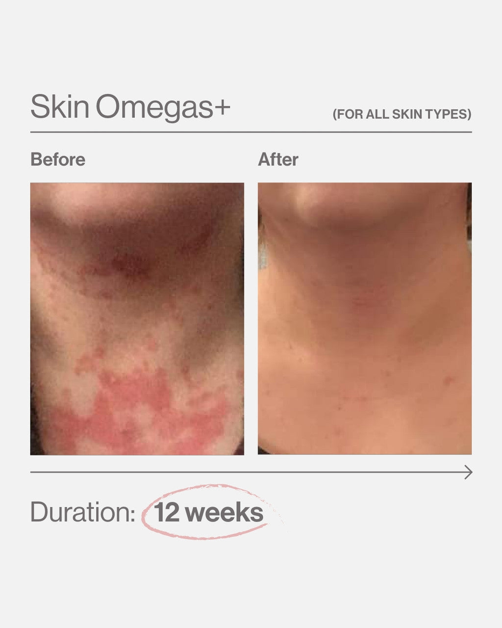 Skin Omegas+