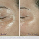 Obagi Medical ELASTIderm Eye Cream 15g
