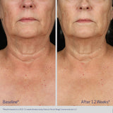 Obagi Medical ELASTIderm Neck and Decollete Concentrate 60ml