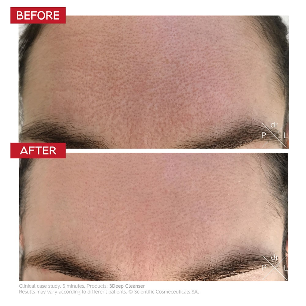3Deep Cleanser / Fast Mask 150ml