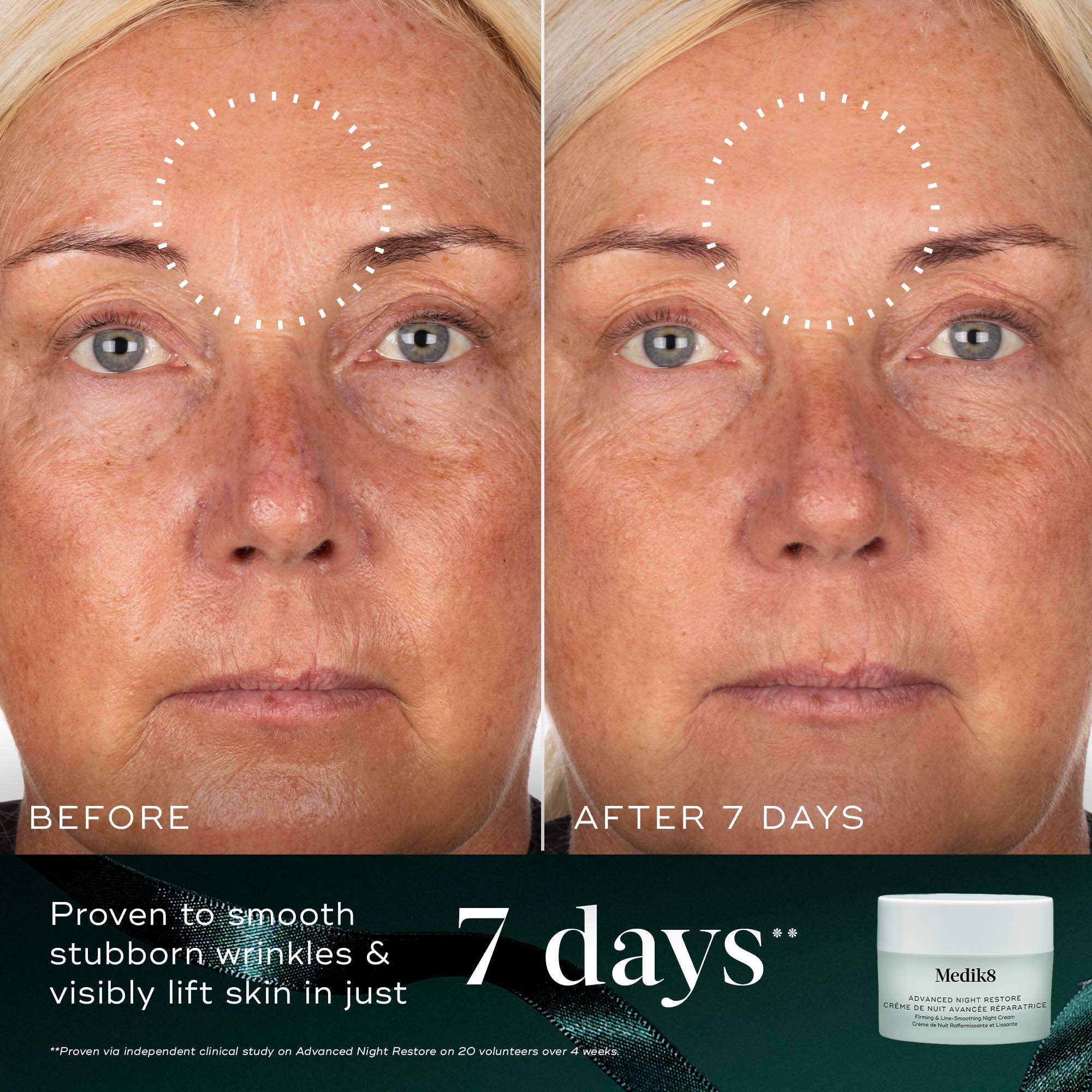 Medik8 Nighttime Nourish