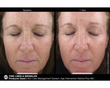 Jan Marini Age Intervention Retinol Plus MD 28g