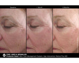 Jan Marini Age Intervention Retinol Plus MD 28g