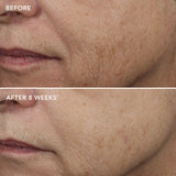Ageless+ Retinol Overnight Masque 0.5% Retinol Complex 50g