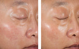 A-Team Duo Kit - Alto Advanced Defense and Repair Serum + AlphaRet Overnight Cream
