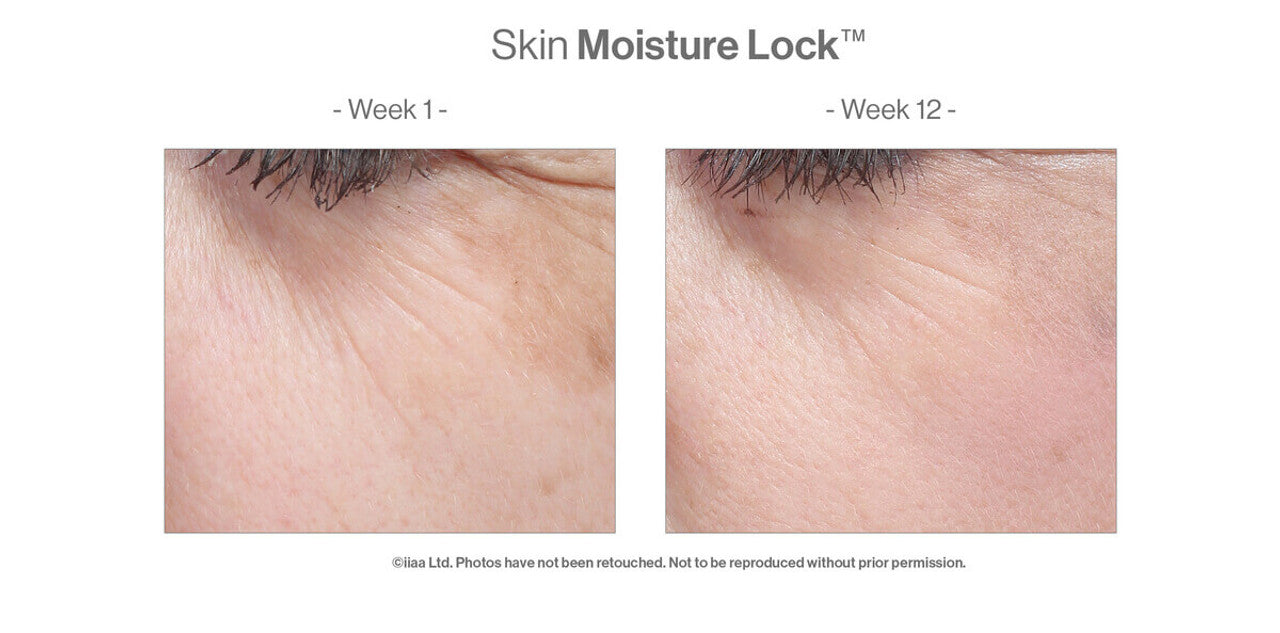 Skin Moisture Lock - Targets Dry Skin