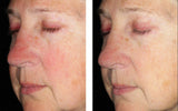 Alto Defense Serum