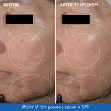 IMAGE MD Restoring Power-C Serum 30ml
