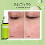 Biome+ Dew Bright Serum 30ml