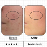 Skin Clear Biome - Targets Problem Skin