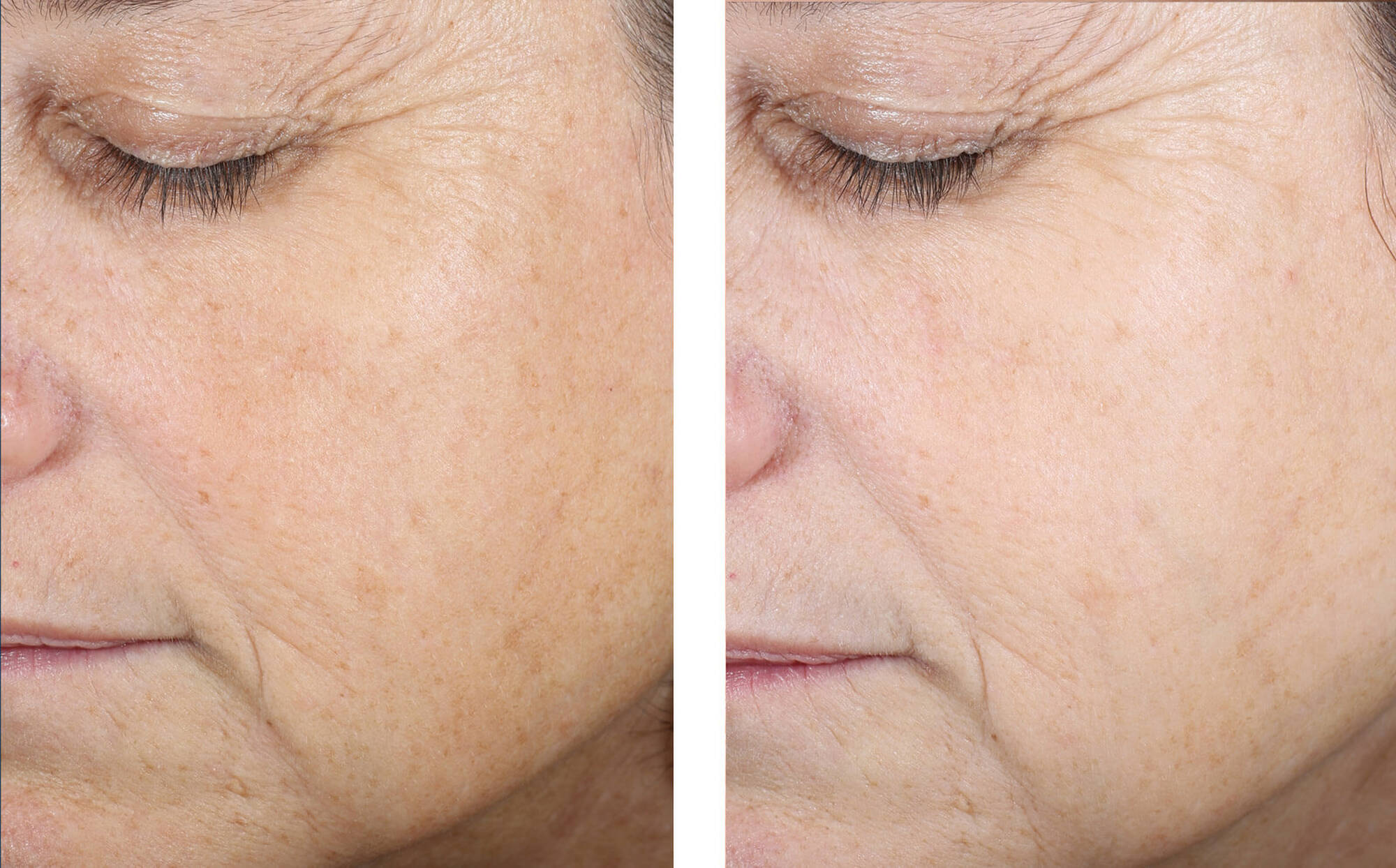 Even Tone Correcting Serum 50ml