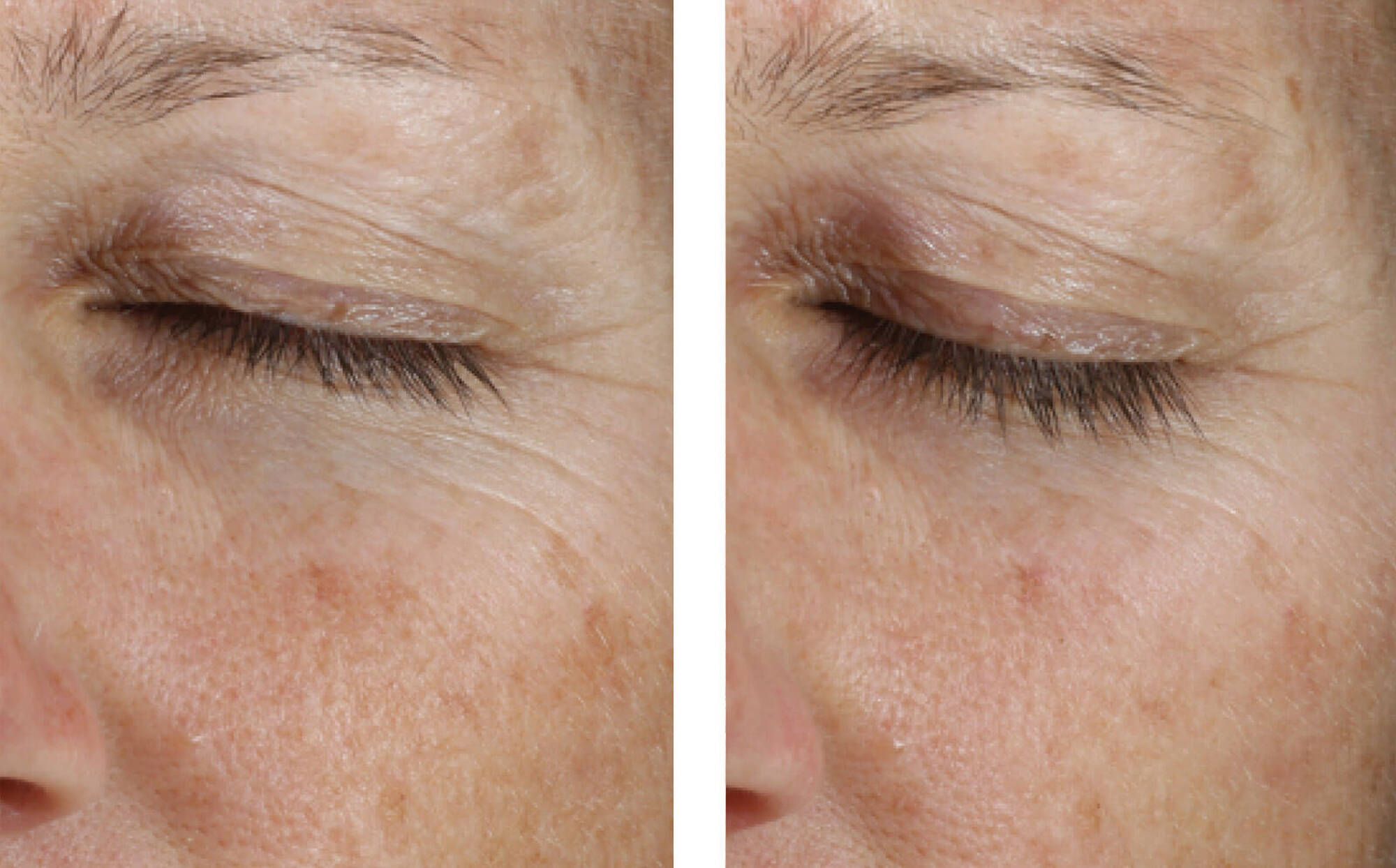 Instant Effect Gel EYE 15ml