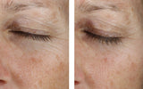 Instant Effect Gel EYE 15ml