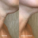 Firm A Fix Neck Serum 50ml
