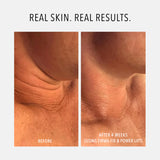 HydroPeptide Firm A Fix Neck Serum 50ml