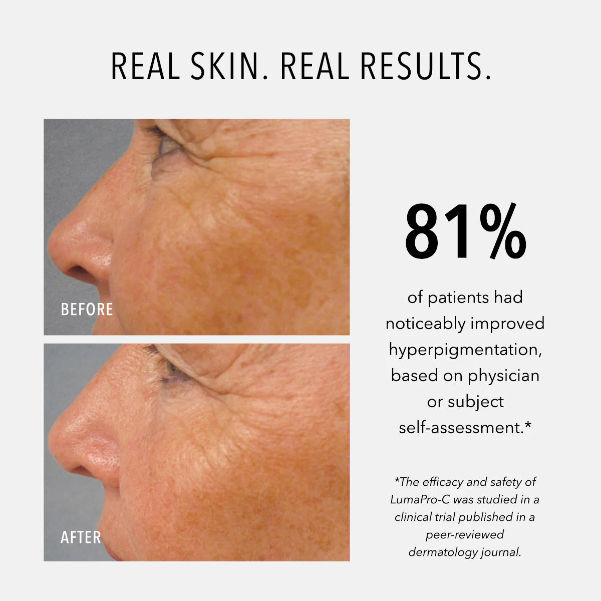 HydroPeptide LumaPro C 30ml