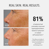 HydroPeptide LumaPro C 30ml