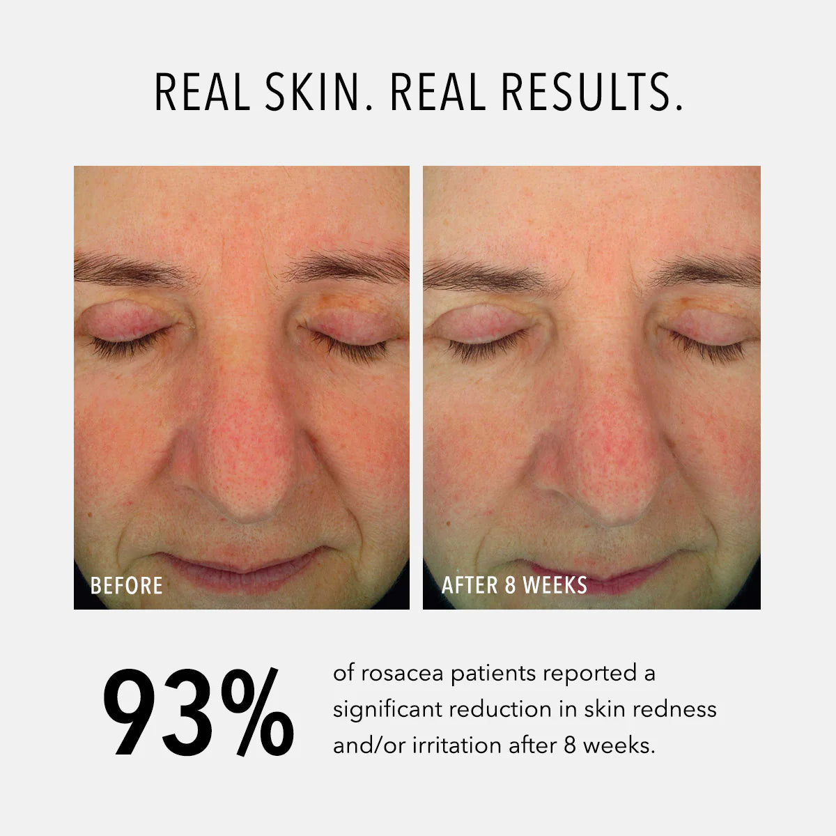 HydroPeptide Soothing Serum 30ml