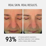 HydroPeptide Soothing Serum 30ml