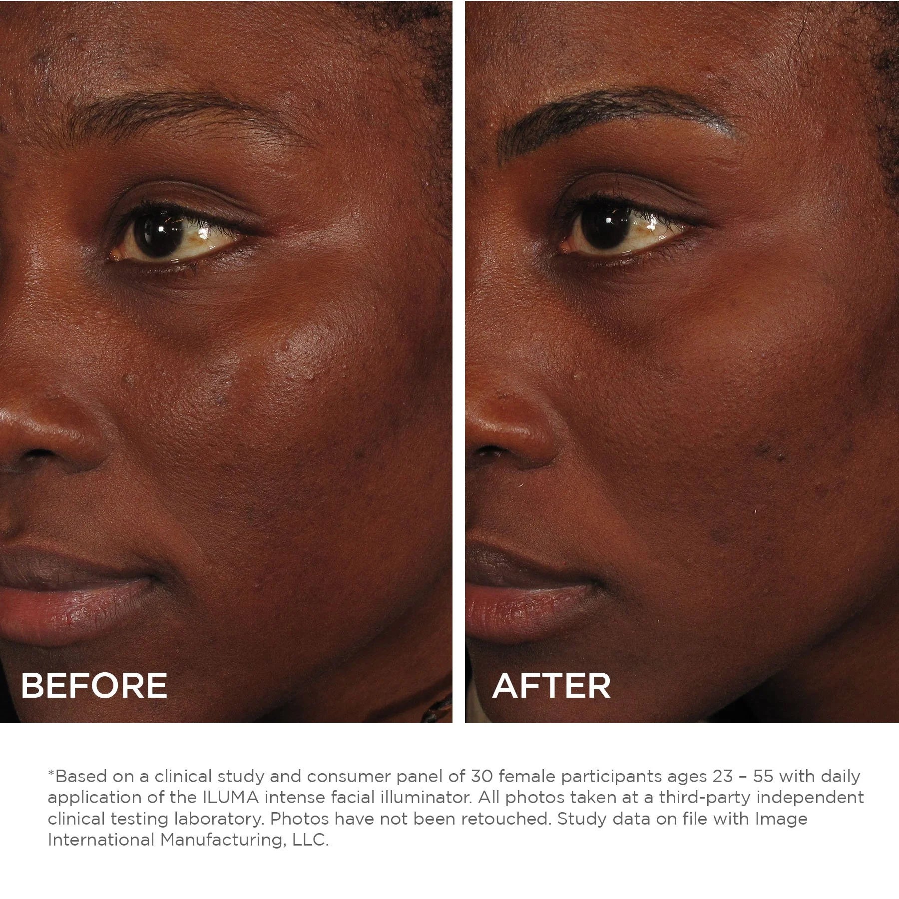 Iluma Intense Facial Illuminator 30ml