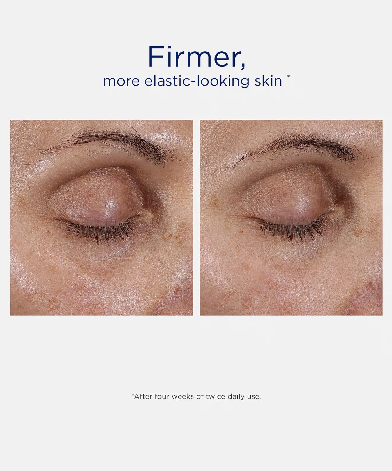Neostrata Skin Active Intensive Eye Therapy 15g