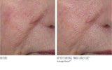 InterFuse Treatment Cream Face & Neck
