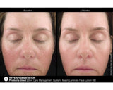 Jan Marini Luminate Face Lotion MD 30ml