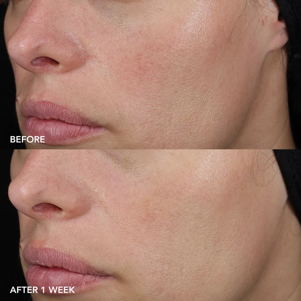 IMAGE MD Barrier Repair Recovery Balm 57g