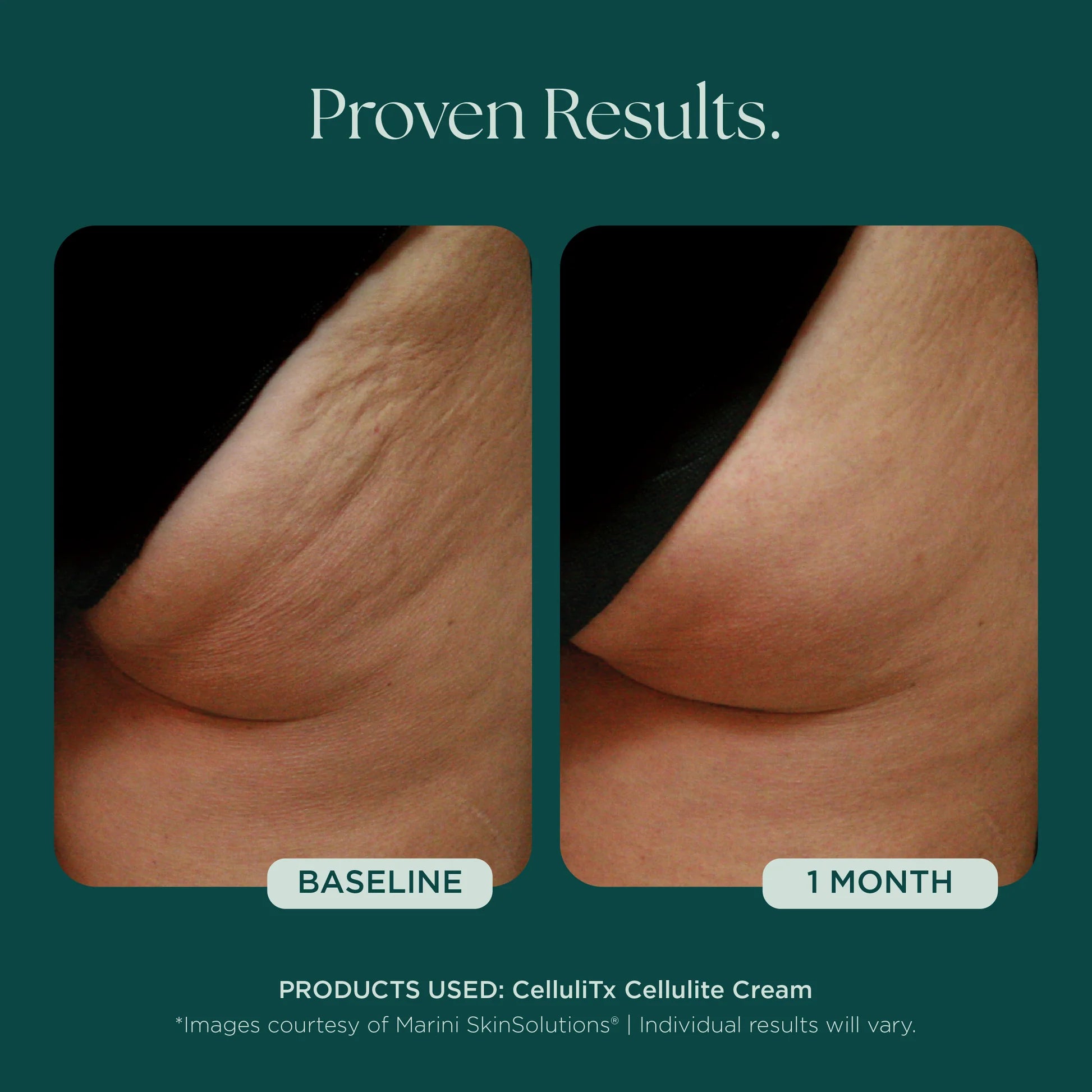 Marini Skin Solutions CelluliTx Cellulite Cream 119ml