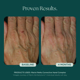 Marini Skin Solutions Marini ReNu Corrective Hand Complex 28g