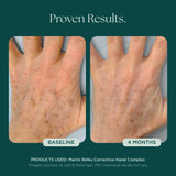 Marini Skin Solutions Marini ReNu Corrective Hand Complex 28g