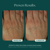 Marini Skin Solutions Marini ReNu Corrective Hand Complex 28g