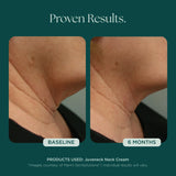 Marini Skin Solutions Juveneck 48g