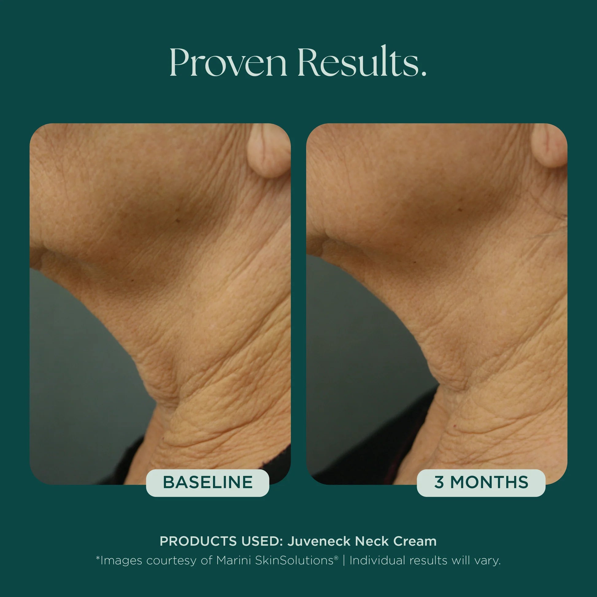 Marini Skin Solutions Juveneck 48g