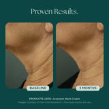 Marini Skin Solutions Juveneck 48g