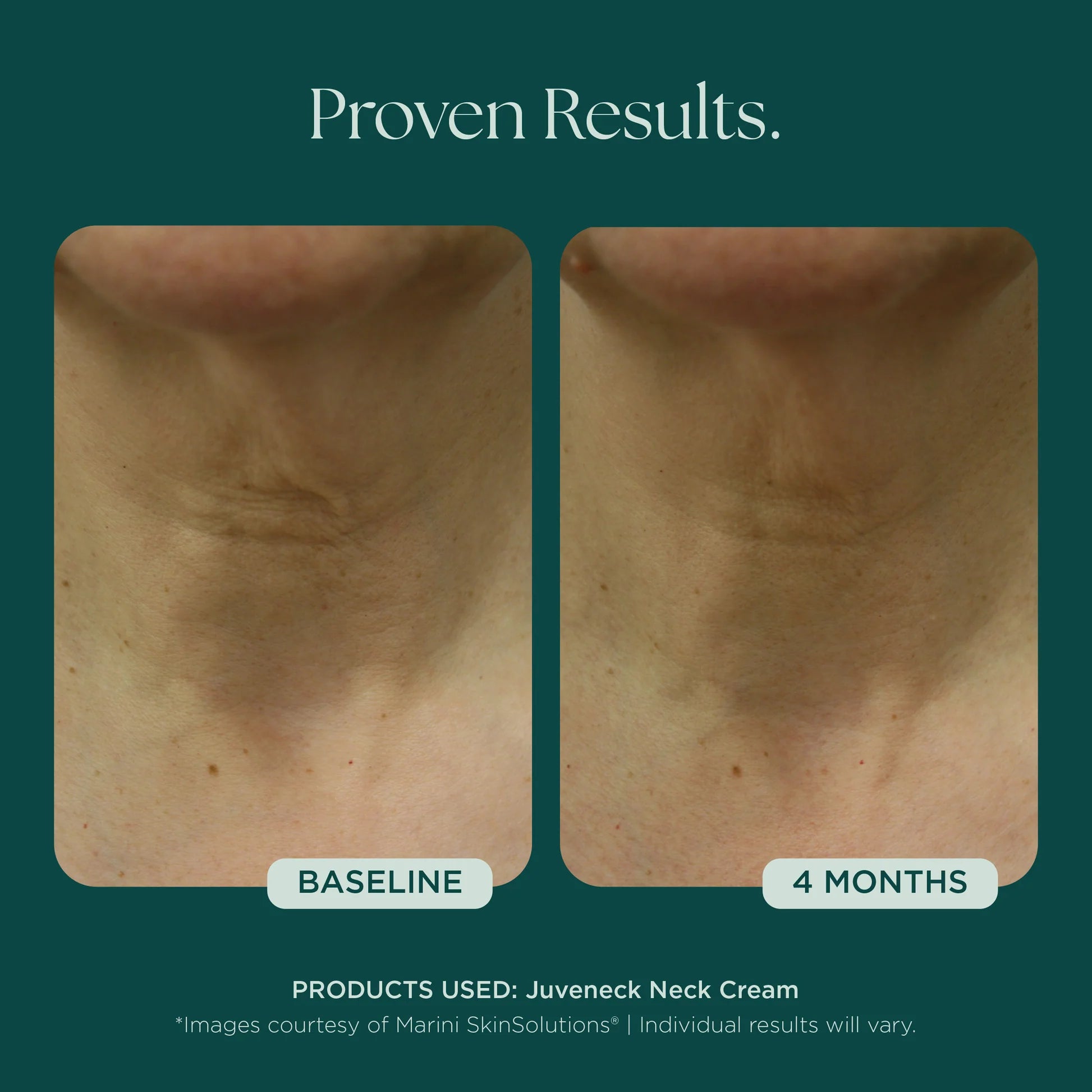 Marini Skin Solutions Juveneck 48g