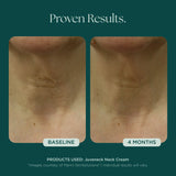 Marini Skin Solutions Juveneck 48g