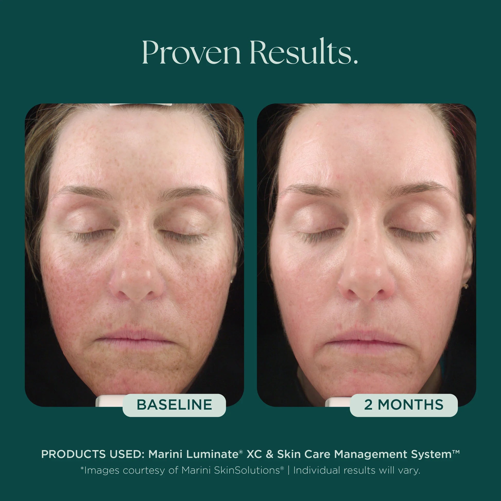 Marini Skin Solutions Luminate XC 30ml