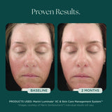 Marini Skin Solutions Luminate XC 30ml